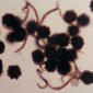 Spores (immature) and elaters